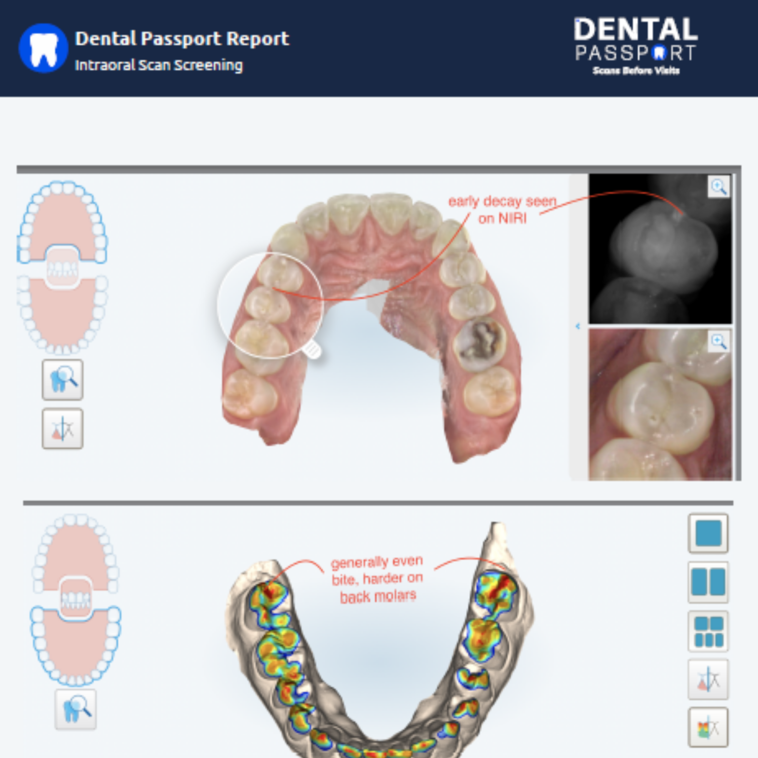 Your Oral Health Platform Dental Passport Scans Before Visits